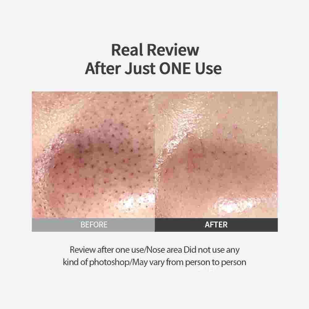 Sungboon Editor Blackhead Melting Clear Pad 30pcs — product image 4