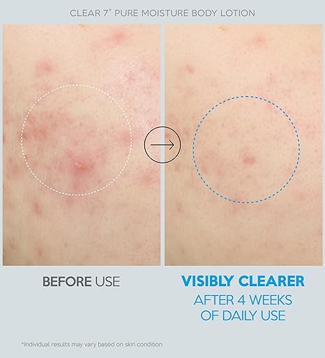 Troubless Clear 7 Plus Pure Moisture Body Lotion 500ml — product image 5