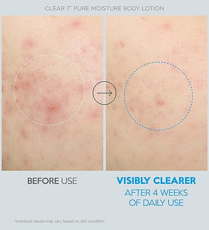 Troubless Clear 7 Plus Pure Moisture Body Lotion 500ml — product image 5
