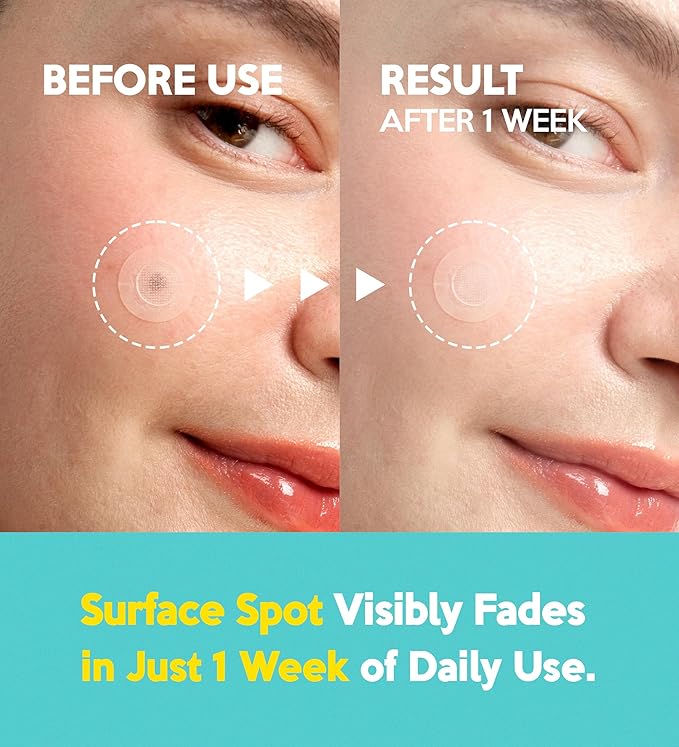 Troubless Micro Point Patch Plus Vitamin C 10% For Dark Spot 9pcs — product image 4