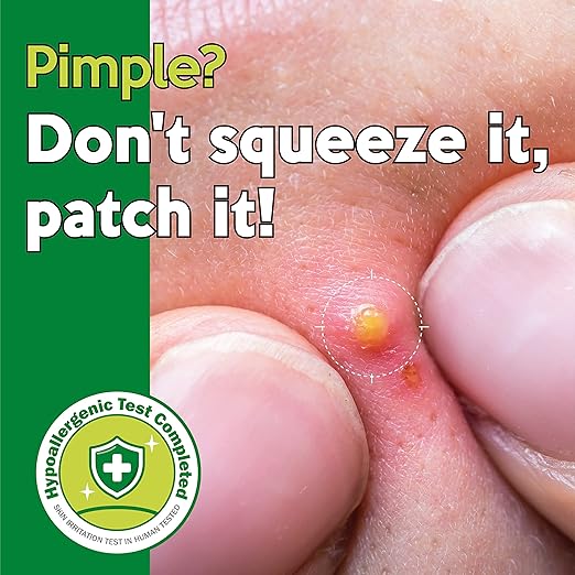 Troubless Micro Point Patch 9pcs — product image 3