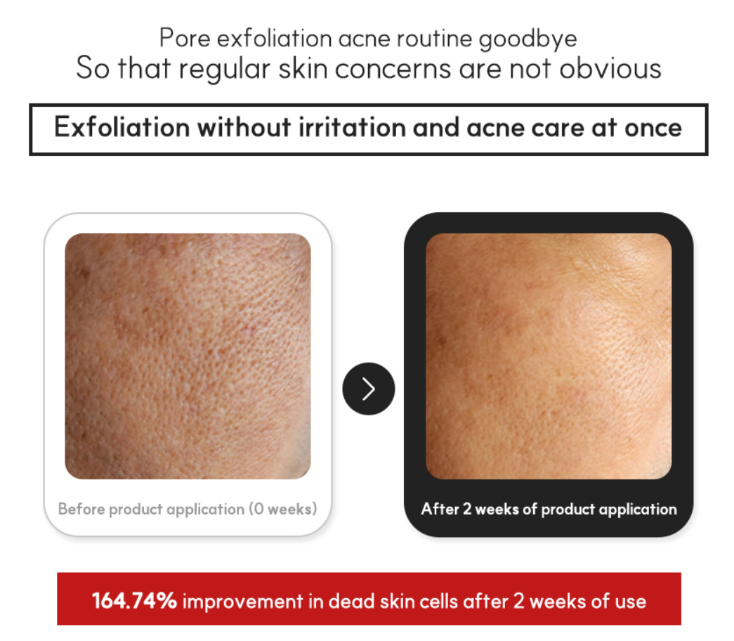 VENDERMA Red Calming Cica Exosome Toner Essence — product image 8