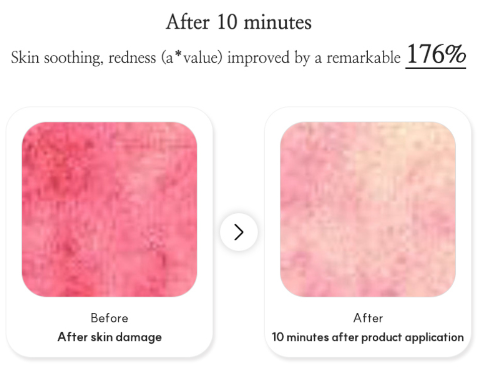 VENDERMA Red Calming Cica Exosome 2 Weeks Intensive Care Program Set — product image 4