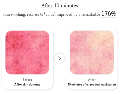 VENDERMA Red Calming Cica Exosome 2 Weeks Intensive Care Program Set — product image 4